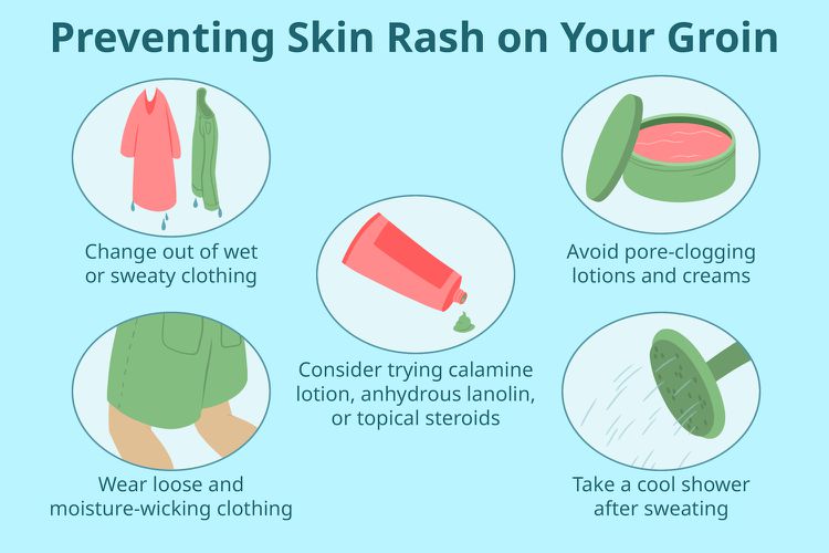 8 Groin Rash Pictures To Identify Symptoms Fast