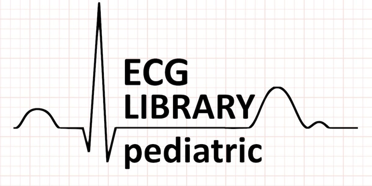 Ecg Lead Placement