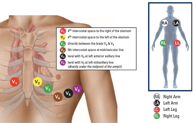 Ecg Placement Leads Diagram