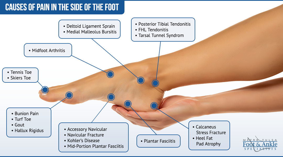 Foot Pain Chart: Instant Relief Guide