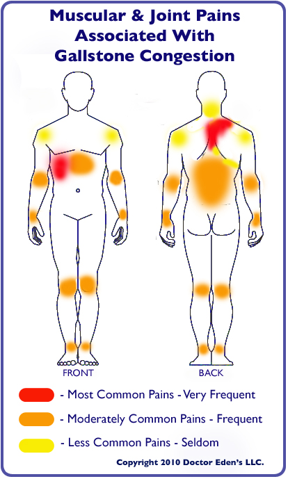 Gallstone Diet What To Do For Gallstones Fatty Liver Disease