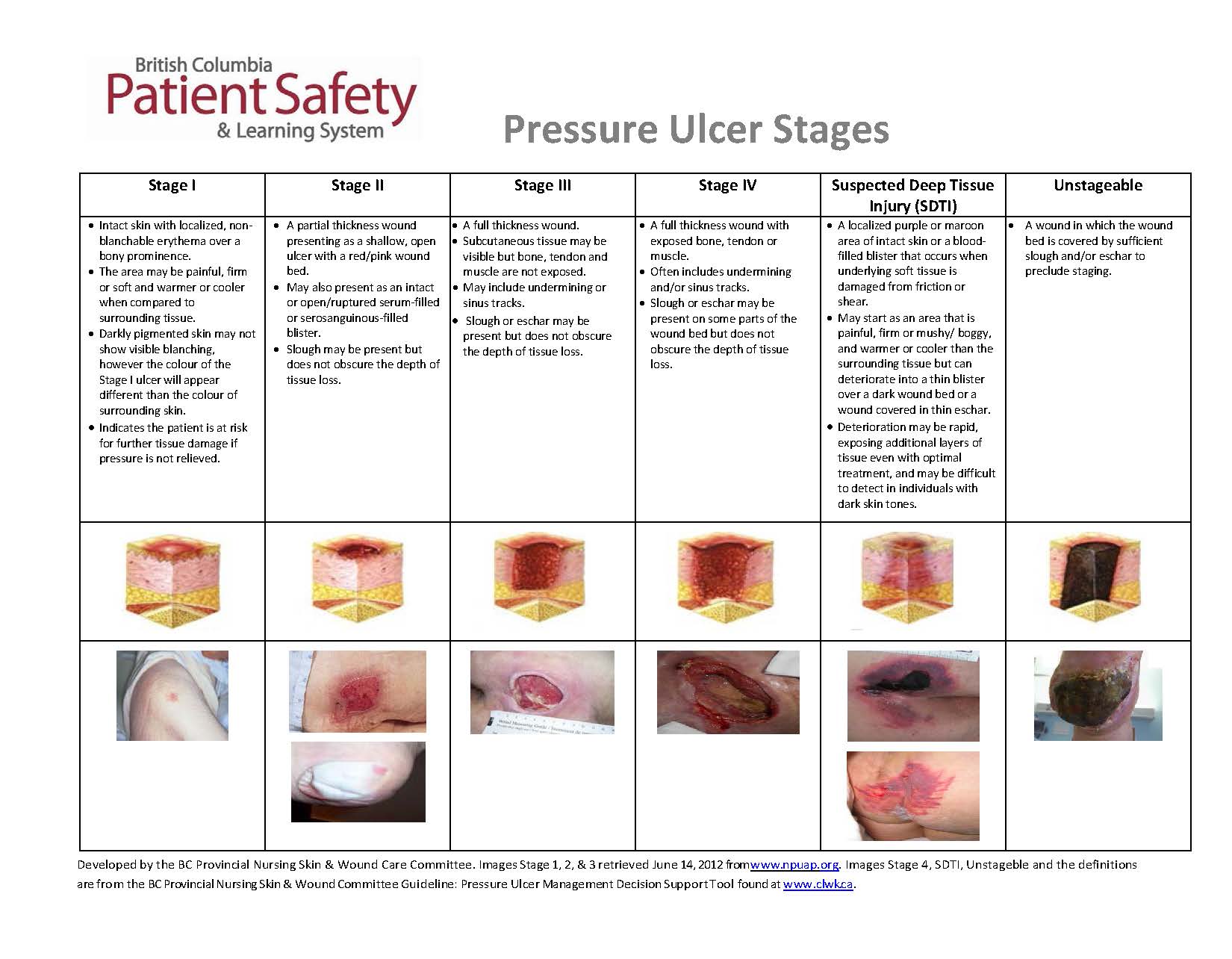 Pressure Ulcer Healing: Stages 3 Care Guide