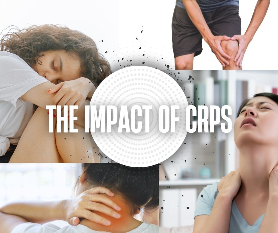 What Is Crps Life Expectancy? Managing Symptoms